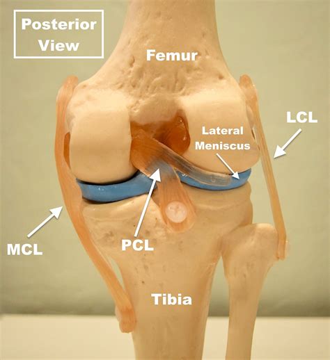 pcl injury prognosis